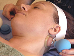 cupping-therapy-neck