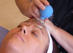facial-cupping-therapy
